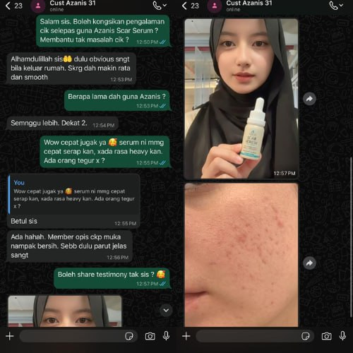 Masalah Parut Jerawat. Dalam seminggu lebih parut jerawat saya Start Pudar — Tak sangka cepat berkesan — Member opis cakap kulit nampak bersih dan parut pun hilang.